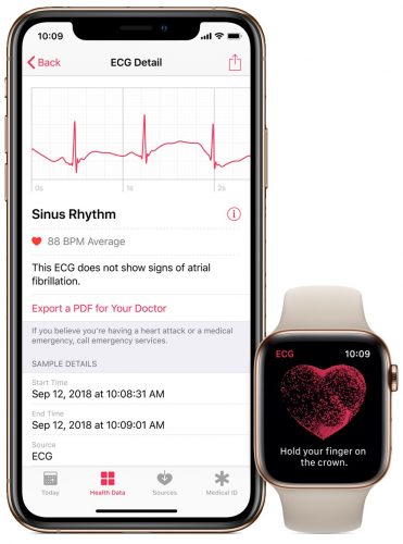 ECG-health-app-irregular-heart-rate-notification - iPhone - Apple - Watch-Series-4-371 × 500 