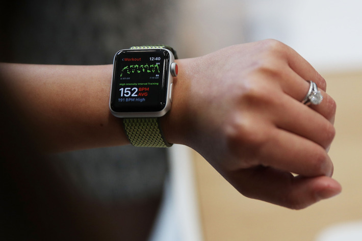 Apple Watch track heart rate irregularities with 97% accuracy