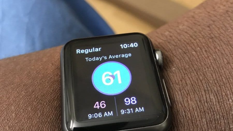 Apple - Watch-heart-watch 